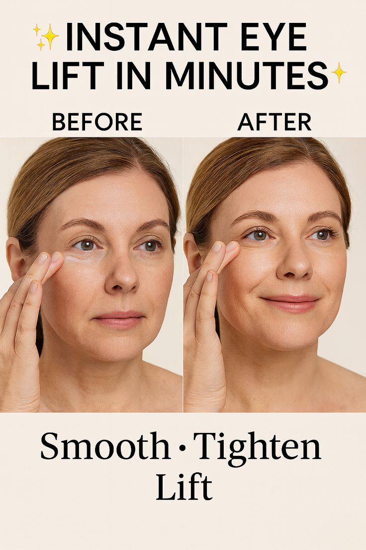 Instant Lid Lifting Eye Treatment | Tighten & Smooth Hooded or Droopy Eyelids