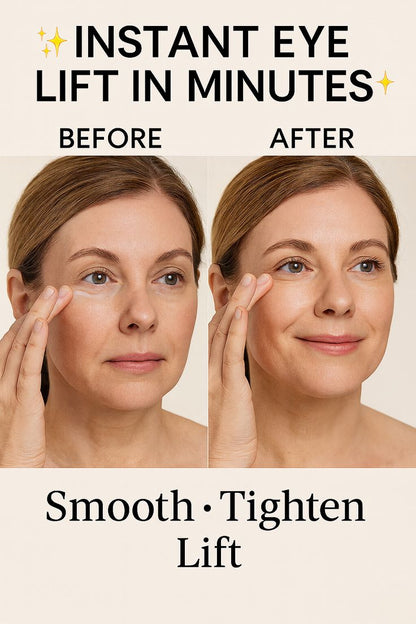 Instant Lid Lifting Eye Treatment | Tighten & Smooth Hooded or Droopy Eyelids